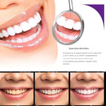 PASTA DENTAL BLANQUEADORA(SMILE EASE) 30ml