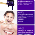 PASTA DENTAL BLANQUEADORA(SMILE EASE) 30ml