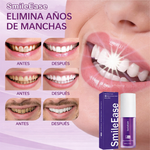 PASTA DENTAL BLANQUEADORA(SMILE EASE) 30ml